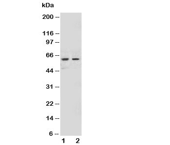 Western blot testing of NOX1 antibody and Lane 1: HeLa; 2: MCF-7 cell lysate~