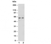 Western blot testing of NOX1 antibody and Lane 1:  human HeLa;  2: human MCF-7 cell lysate.