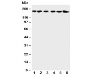 Western blot testing of ALK antibody and Lane 1:  rat brain;  2: rat testis;  3: human U87;  4: HeLa;  5: COLO320;  6: Jurkat cell lysate.  Predicted molecular weight: 190-220 kDa.