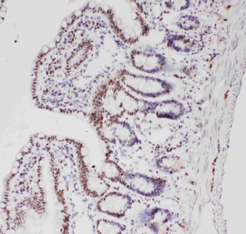 IHC staining of FFPE rat intestine with ALK antibody. HIER: boil tissue sections in pH6 citrate buffer for 20 min and allow to cool before testing.