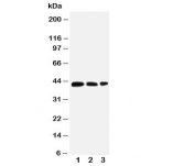 Western blot testing of AQP2 antibody and Lane 1:  MCF-7;  2: SW620;  3: HT1080 cell lysate.  The protein is routinely visualized from 29-46kDa depending on glycosylation level.