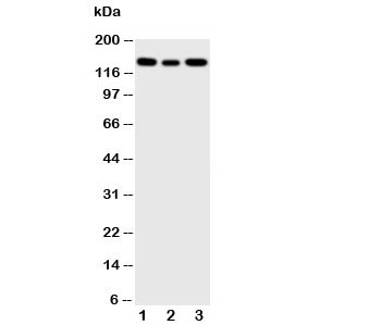 Western blot testing of IGF1R antibody and Lane 1: 293T; 2: A549; 3: MCF-7 cell lysate. Predicted molecular weight: ~200 kDa (pro), 120-130 kDa (alpha), 90-97 kDa (beta).~