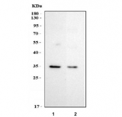Western blot testing of 1) 10ng of recombinant human IL2RA protein and 2) 5ng of recombinant human IL2RA protein with IL2RA antibody.