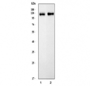 Western blot testing of 1) rat brain and 2) mouse brain tissue lysate with MAG antibody.  The protein is routinely visualized from 68~98 kDa, depending on level of glycosylation.