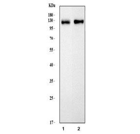 Western blot testing of 1) rat brain and 2) mouse brain tissue lysate with MAG antibody.  The protein is routinely visualized from 68~98 kDa, depending on level of glycosylation.