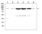 Western blot testing of 1) rat brain, 2) mouse brain, 3) human HeLa, 4) human 22RV1, 5) human U-87 MG and 6) mouse Neuro-2a cell lysate with TRPC3 antibody. Predicted molecular weight ~96/106/97 kDa (isoforms 1/2/3).