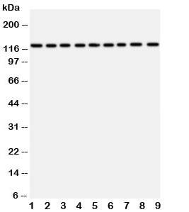 Western blot testing of TRPC3 antibody and Lane 1: rat liver; 2: (r) lung; 3: (r) intestine; 4: (r) ovary; 5: human U87; 6: (h) A549; 7: (h) COLO320; 8: (h) SW620; 9: (h) HeLa~