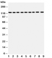 Western blot testing of TRPC3 antibody and Lane 1:  rat liver;  2: (r) lung;  3: (r) intestine;  4: (r) ovary;  5: human U87;  6: (h) A549;  7: (h) COLO320;  8: (h) SW620;  9: (h) HeLa lysate. Predicted molecular weight ~96/106/97 kDa (isoforms 1/2/3), observed here at ~120 kDa.