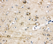 IHC-P: TRPC3 antibody testing of FFPE rat brain tissue. Required HIER: steam section in pH6 citrate buffer for 20 min.