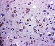 IHC-P: TRPC6 antibody testing of rat brain tissue