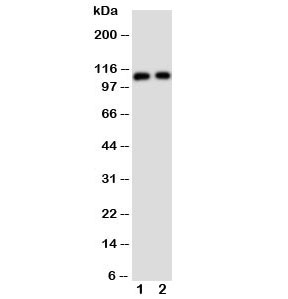 Western blot testing of TRPC6 antibody and Lane 1: rat lung; 2: human 293T cell lysate
