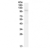 Western blot testing of mouse lung lysate with TRPC6 antibody. Predicted molecular weight: ~106 kDa.