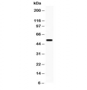 Western blot testing of VIPR1 antibody and human placenta lysate; Predicted molecular weight ~52 kDa.
