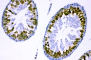 IHC staining of FFPE rat testis tissue with YB1 antibody. HIER: boil tissue sections in pH8 EDTA for 20 min and allow to cool before testing.