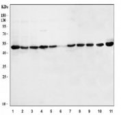 Western blot testing of 1) human MCF7, 2) human 293T, 3) human HeLa, 4) human Jurkat, 5) human T-47D, 6) human ThP-1, 7) human MOLT-4, 8) human HL60, 9) rat testis, 10) mouse stomach and 11) mouse testis tissue lysate with YB1 antibody. Expected molecular weight: 39-50 kDa depending on glycosylation level.