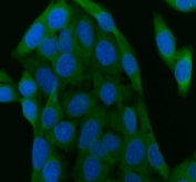 Immunofluorescent staining of FFPE human HeLa cells with SIP antibody (green) and DAPI nuclear stain (blue). HIER: steam section in pH6 citrate buffer for 20 min.