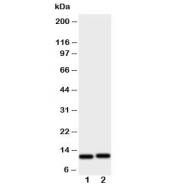 Western blot testing of GRO alpha antibody and human samples: 1) HeLa and 2) Jurkat cell lysate. Predicted molecular weight ~11 kDa.