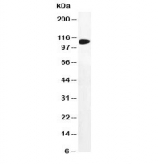 Western blot testing of DPYD antibody and human MDA-MB-231 cell lysate. Predicted molecular weight ~111 kDa.