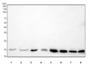 Western blot testing of 1) human MCF7, 2) human MDA-MB-453, 3) human Caco-2, 4) human HepG2, 5) rat skeletal muscle, 6) rat heart, 7) mouse skeletal muscle and 8) mouse heart tissue lysate with DUSP3 antibody. Predicted molecular weight ~20 kDa.