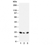 Western blot testing of DUSP3 antibody and Lane 1:  rat testis;  2: human SKOV;  3: (h) MM453 cell lysate. Predicted molecular weight ~20 kDa.