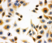 ICC testing of HeLa cells. HIER: boil tissue sections in pH6, 10mM citrate buffer, for 10-20 min and allow to cool before testing.