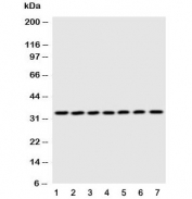 Western blot testing of DCI antibody and Lane 1:  rat liver;  2: human placenta;  3: A549;  4: SMMC-7721;  5: COLO320;  6: HeLa;  7: HT1080 cell lysate. Predicted molecular weight ~33 kDa.