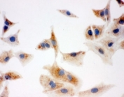 ICC testing of A549 cells. HIER: boil tissue sections in pH6, 10mM citrate buffer, for 10-20 min and allow to cool before testing.