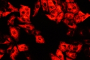 IF/ICC staining of FFPE human A549 cells with DCI antibody (red) at 2ug/ml. HIER: steam section in pH6 citrate buffer for 20 min.