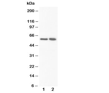 Western blot testing of FMO3 antibody and Lane 1: rat liver; 2: rat liver