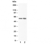 Western blot testing of FMO3 antibody and Lane 1:  rat liver;  2: rat liver. Predicted/observed molecular weight ~60kDa.