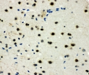 IHC-P: MCM6 antibody testing of rat brain tissue. HIER: steamed with pH6 citrate buffer.