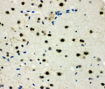 IHC-P: MCM6 antibody testing of rat brain tissue. HIER: steamed with pH6 citrate buffer.
