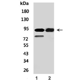 Western blot testing of mouse 1) small intestine and 2) spleen lysate with MCM6 antibody. Predicted molecular weight: ~93 kDa.