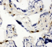 IHC staining of frozen human placenta tissue with MCM6 antibody.