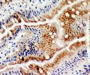 IHC staining of FFPE rat intestine with MCM6 antibody. HIER: boil tissue sections in pH8 EDTA for 20 min and allow to cool before testing.