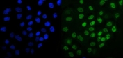 Immunofluorescent staining of FFPE human A431 cells with MCM6 antibody (green) and DAPI nuclear stain (blue). HIER: steam section in pH6 citrate buffer for 20 min.