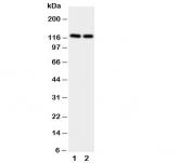 Western blot testing of NRP2 antibody and Lane 1:  rat brain;  2: rat testis.  Predicted size: 116-130KD