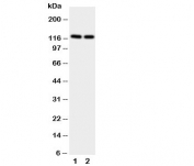 Western blot testing of NRP2 antibody and Lane 1:  rat brain;  2: rat testis.  Predicted size: 116-130KD