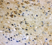 IHC-P: Rab5 antibody testing of rat brain tissue. HIER: steamed with pH6 citrate buffer.