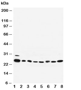 Western blot testing of Rab5 antibody and Lane 1: rat brain; 2: rat ovary; 3: human placenta; 4: HeLa; 5: 293T; 6: A375; 7: COLO320; 8: MM453 cell lysate. Expected size ~25KD~