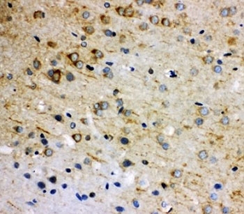 IHC-P: Rab5 antibody testing of rat brain tissue. HIER: steamed with pH