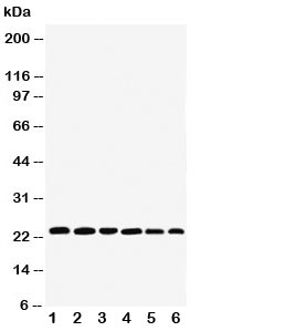 Western blot testing of SNAP23 antibody and Lane 1: rat spleen; 2: (r) testis; 3: (r) ovary; 4: human HeLa; 5: (h) MCF-7; 6: (h) SKOV; Expected size: ~23KD