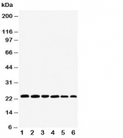 Western blot testing of SNAP23 antibody and Lane 1:  rat spleen;  2: (r) testis;  3: (r) ovary;  4: human HeLa;  5: (h) MCF-7;  6: (h) SKOV;  Expected molecular weight: ~23/18kDa (isoforms 1/2).