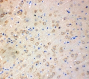 IHC-P: SOD2 antibody testing of rat brain tissue