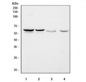 IHC-P: SPTLC1 antibody testing of human breast cancer tissue