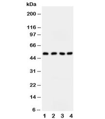 Western blot testing of SPTLC1 antibody and Lane 1: SW620; 2: S549; 3: PANC; 4: U87 cell lysate~