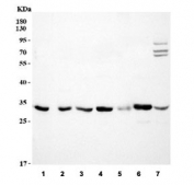 Western blot testing of 1) human HeLa, 2) human A431, 3) human 293T, 4) rat brain, 5) rat NRK, 6) mouse brain and 7) mouse NIH 3T3 cell lysate.  Expected molecular weight: ~31 kDa.