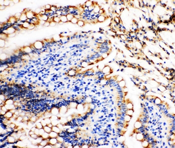 IHC-P: Vinculin antibody testing of rat intestine tissue