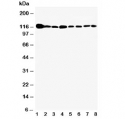 Western blot testing of Vinculin antibody and Lane 1:  rat heart;  2: (r) brain;  3: (r) liver;  4: human U87;  5: (h) SMMC-7721;  6: mouse HEPA;  7: (h) HeLa;  8: (h) HT1080 cell lysate. Predicted molecular weight ~124 kDa.