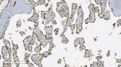 IHC staining of FFPE human placental tissue with Aryl hydrocarbon Receptor antibody. HIER: boil tissue sections in pH8 EDTA for 20 min and allow to cool before testing.